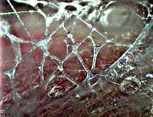 Microscopic view of living fascia